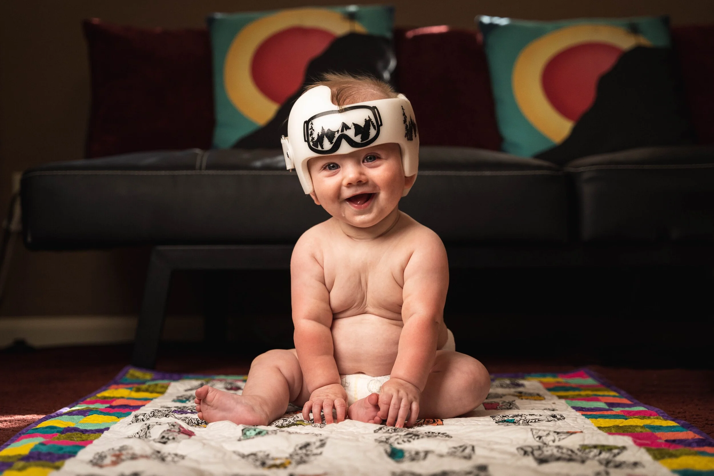 Head flatness in babies sales